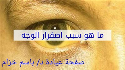 اصفرار الوجه: الأسباب والعلاج