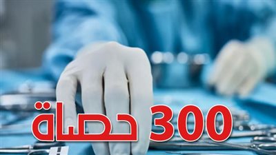 استئصال المرارة بنجاح بعد استخراج أكثر من 300 حصاة في الجزائر