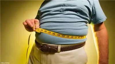 Obesity: Definition, Causes, and Effects