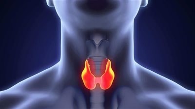 Hypothyroidism: Symptoms, Causes, and Treatment