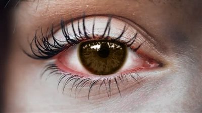 العين الوردية تنتشر في آسيا.. كيف تحمي نفسك؟