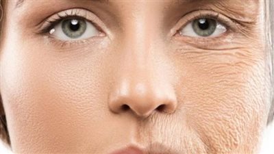 How to Stay Young