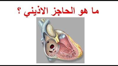 عېب الحاجز الأذيني : 5 معلومات لا نعرفها