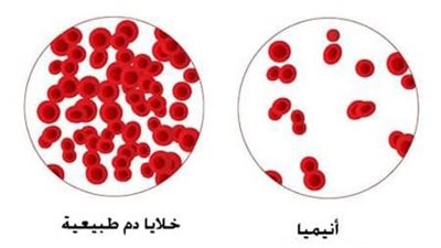 أطعمة غنية بالحديد : وداعاً للأنيميا