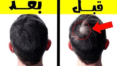 زيت الخروع لنمو الشعر : فوائده وطرق استخدامه