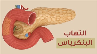 التـهاب البنكرياس : أسبابه وأعراضه وعلاجه