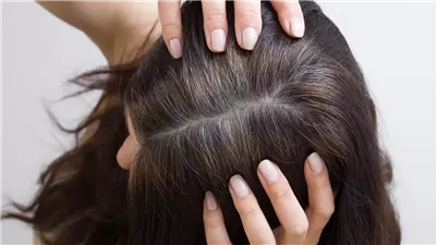 أطعمة غير متوقعة قد تساعد على منع الشيب المبكر
